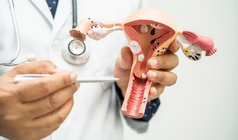 différents stades du cancer de l'utérus